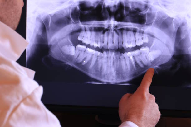 Best Pediatric Emergency Dentist in Butler, NJ